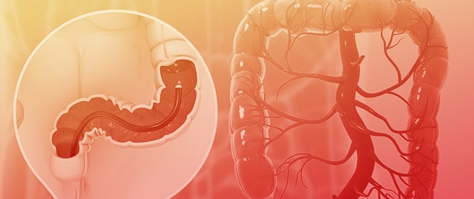 Development and Internal Validation of a Machine Learning-Based Colorectal Cancer Risk Prediction Model