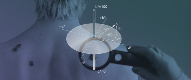 Optimizing Digital Image Quality for Improved Skin Cancer Detection
