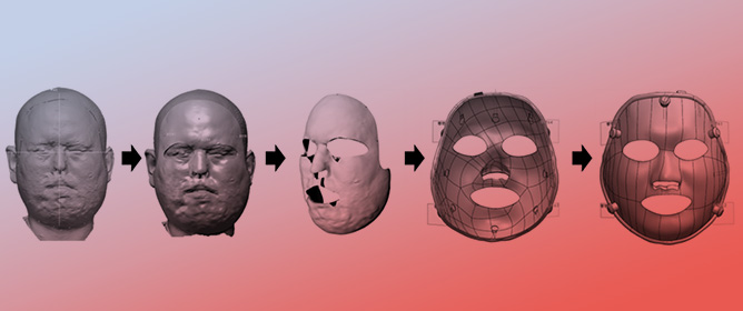 Preliminary Study on Pressure-Monitoring Facial Mask for Burn Rehabilitation