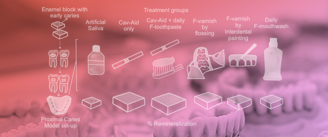 Enhanced Proximal Caries Remineralization Using Cav-Aid<sup>&reg;</sup>, a Novel Fluoride Delivery Device
