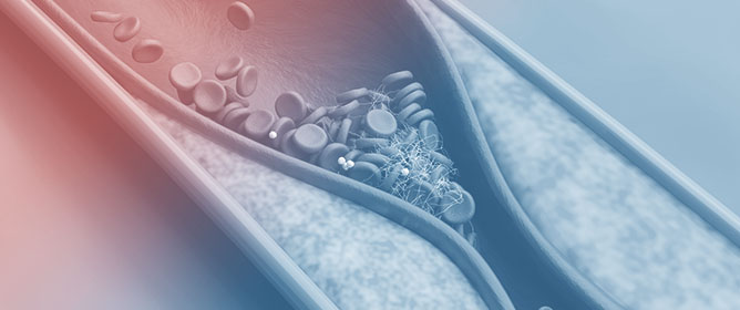 Sex Differences in Epicardial Adipose Tissue and Other Risk Factors for Coronary Artery Disease
