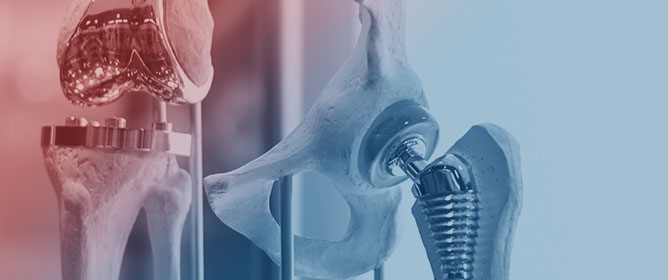 Influence of Prosthetic Emergence Profile on Peri-Implant Marginal Bone Stability: A Comprehensive Review