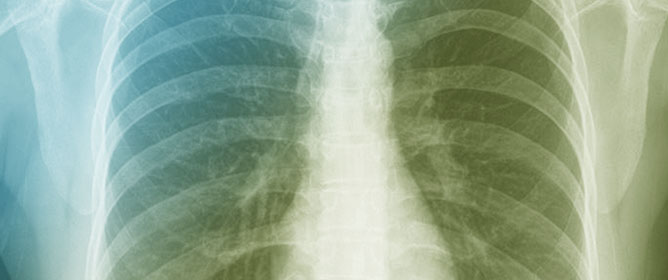 MDFormer: Transformer-Based Multimodal Fusion for Robust Chest Disease Diagnosis