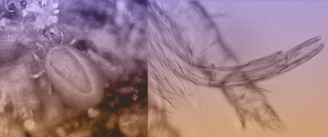 Poultry Mites Contributing to Human Dermatitis: A Retrospective Study in Italy (2010&ndash;2024)