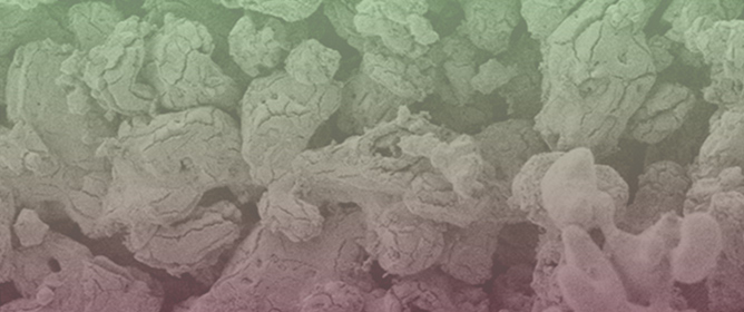 Structural and Morphological Investigation of Calcium-Silicate-Based Bioceramics Prepared from Eggshell via Conventional Approach