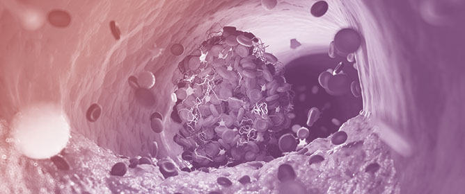 Percutaneous Coronary Intervention for Left Main Disease in High Bleeding Risk: Outcomes from a Subanalysis of the Delta 2 Registry