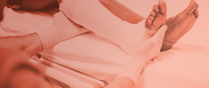 Incisional Negative Pressure Wound Therapy Use on Orthopaedic Lower Extremity Trauma: An Updated Systematic Global Review