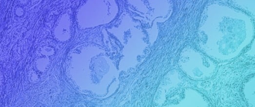ELK1, c-Jun, and STAT3 Mediate Bortezomib Resistance in Prostate Cancer Cells