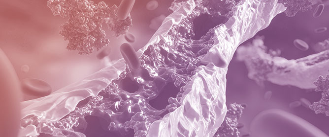 Leaving Nothing Behind: Expanding the Clinical Frontiers of Drug-Coated Balloon Angioplasty in Coronary Artery Disease