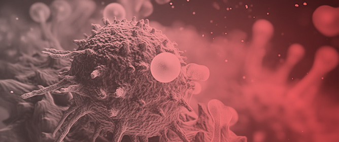 BET Protein Inhibition Relieves MDSC-Mediated Immune Suppression in Chronic Lymphocytic Leukemia