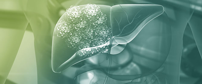 Sorafenib&mdash;Drug Delivery Strategies in Primary Liver Cancer