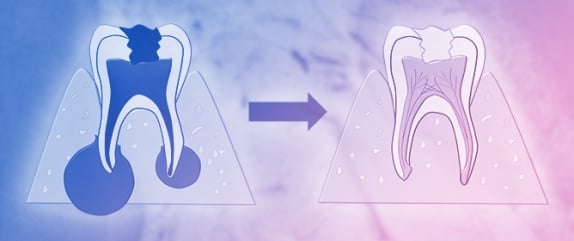 Current Strategies in Endodontic Regeneration