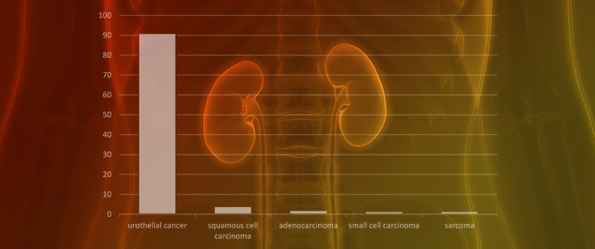 A Narrative Review of Current Advances and Future Changes Regarding Bladder Cancer Treatment