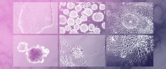 A Refined Approach to Isolate Interneurons for High-Validity Epigenetic Studies in Human Brain Tissue