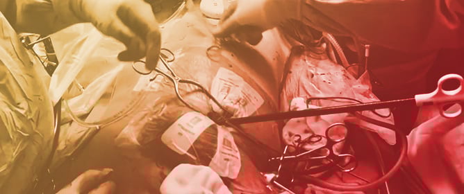 Implementation of Minimally Invasive Mitral Valve Surgery in a Novice Center