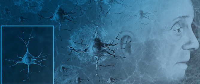 Isoforms of Phosphorylated Tau as Potential Biomarkers for Alzheimer&rsquo;s Disease: The Contribution of Mass Spectrometry-Based Proteomics