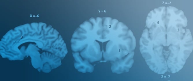 The Functional Neuroanatomy of Dyspnea