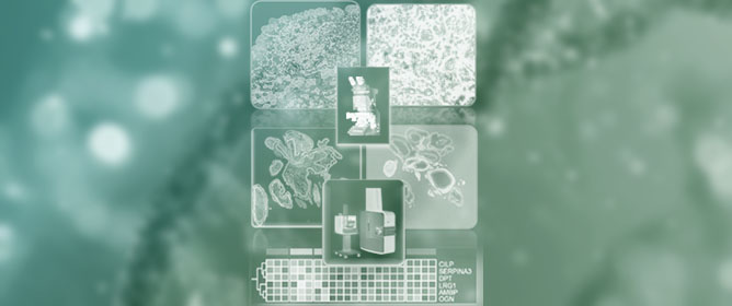 Integrative Spatial Proteomics and Single-Cell RNA Sequencing Unveil Molecular Complexity in Rheumatoid Arthritis for Novel Therapeutic Targeting