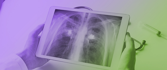 EBUS-Based Lung Cancer Diagnosis Using Multi-Scale and Multi-Feature Fusion