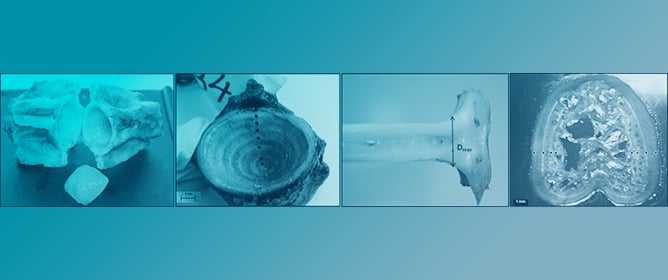 Ageing Mediterranean Bluefin Tuna: A Comparative Study Between Dorsal Fin Spines and Vertebrae