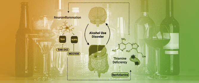Thiamine Deficiency and Neuroinflammation Are Important Contributors to Alcohol Use Disorder