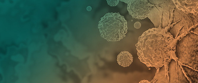 Immunosuppressants/Immunomodulators and Malignancy