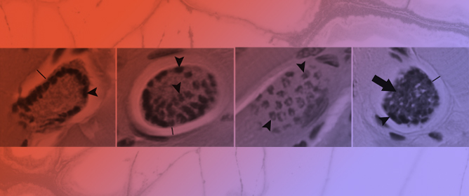 <em>Sarcocystis</em> and <em>Hepatozoon</em> Infections in Tongues of Bobcats (<em>Lynx rufus</em>) in Oklahoma, USA