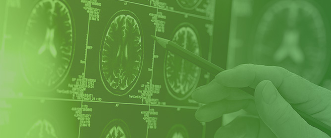 Applications of Advanced Imaging for Radiotherapy Planning and Response Assessment in the Central Nervous System