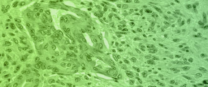 Predicting Molecular Biomarkers in WHO Grade 4 Glioma via APTw‑MRI