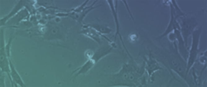Dual Inhibition of HIF-1&alpha; and HIF-2&alpha; as a Promising Treatment for VHL-Associated Hemangioblastomas: A Pilot Study Using Patient-Derived Primary Cell Cultures