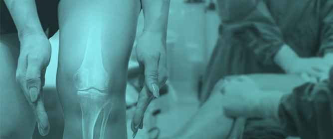 Inter-Critical Gout, Not Hyperuricemia or Asymptomatic Urate Crystal Deposition, Is Associated with Systemic Inflammation
