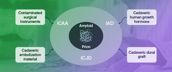 Iatrogenic Dementia: Providing Insight into Transmissible Subtype of AD, CJD and CAA