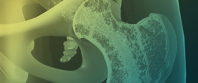 The Long-Term Impact of Preterm Birth on Metabolic Bone Profile and Bone Mineral Density in Childhood