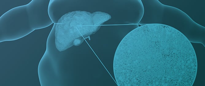 Impact of Short-Term Liraglutide Therapy on Non-Invasive Markers of Liver Fibrosis in Patients with MASLD