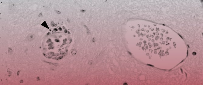Spatiotemporal Characterization of Changes in the Respiratory Tract and the Nervous System, Including the Eyes in SARS-CoV-2-Infected K18-hACE2 Mice