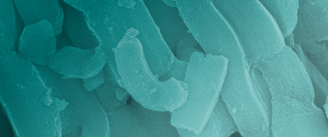 Interaction of SBA-15 with Dilute Acetic Acid and Ammonia