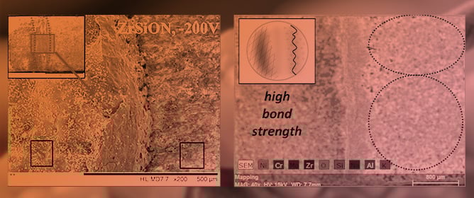 Improved Bond Strength of NiCr Alloy-Ceramic Restorations by PVD (Cr,Zr)SiON Thin Films