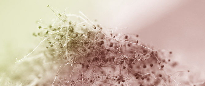 Cell Type-Specific Effects of <em>Fusarium</em> Mycotoxins on Primary Neurons and Astroglial Cells