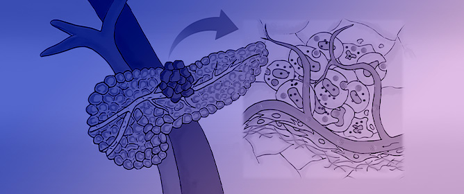 Nanocarriers for Combination Therapy in Pancreatic Ductal Adenocarcinoma: A Comprehensive Review