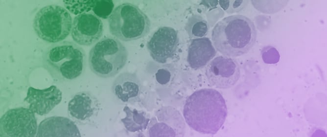 The Proteomic Signature of Oxidative Stress in Myelodysplastic Syndromes