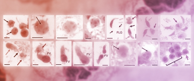 Tickborne <em>Colpodella</em> Species Infections