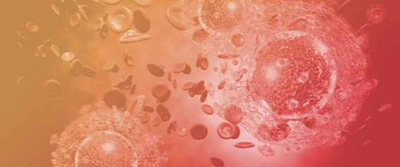 Unveiling the Mechanisms of Cancer-Selective Nanoparticles