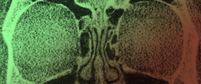 Addition of In-Clinic Cone-Beam CT Imaging to a Public Hospital Rhinology Clinic: Early Experience
