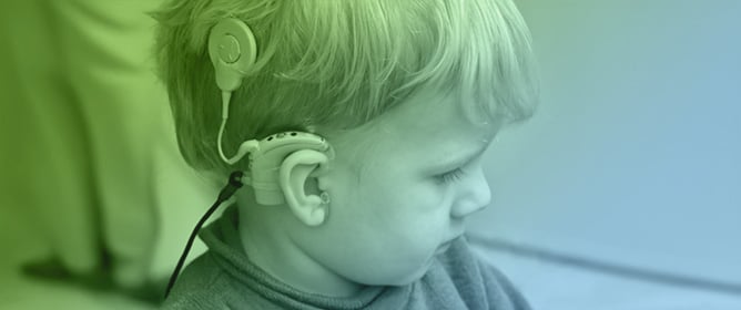 Beyond Estimation: The Clinical Case for Behavioral Threshold Programming in Cochlear Implants