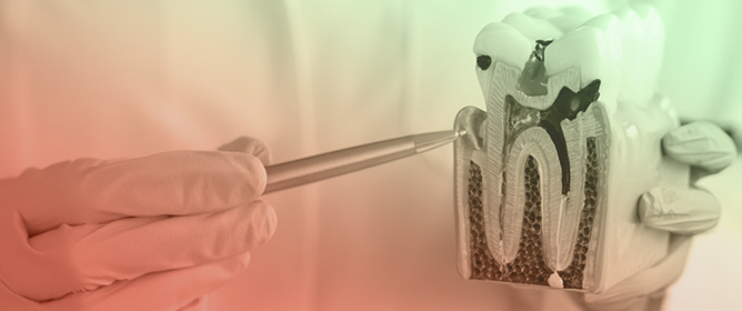 Final Restorative Diagnosis Determines Tooth&rsquo;s Restorability of Structurally Compromised Tooth