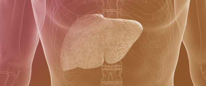 Effects of <em>Aronia melanocarpa</em>-Based Fruit Juices on Metabolic Dysfunction-Associated Fatty Liver Disease in Rats