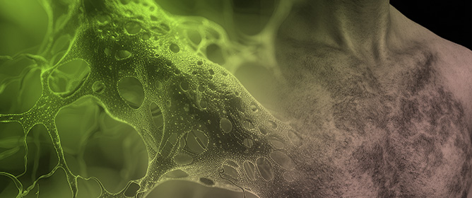 Biologic Therapies and Janus Kinase Inhibitors for Medium and Variable Vessel Vasculitides: A Review of Clinical and Preclinical Evidence