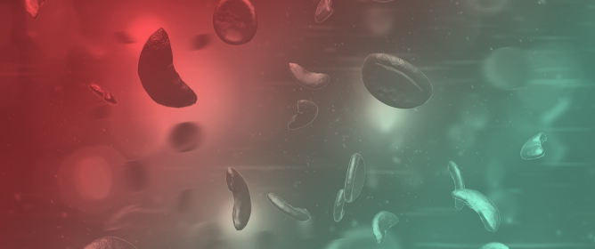 Interplay Between Sickle Cell Disease and Thrombosis: A Single Center Experience of Pathophysiology and Potential Risk Factors