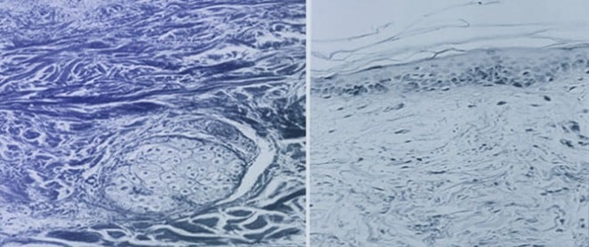 Microvascular Responses in the Dermis and Muscles After Balneotherapy: Results from a Prospective Pilot Histological Study
