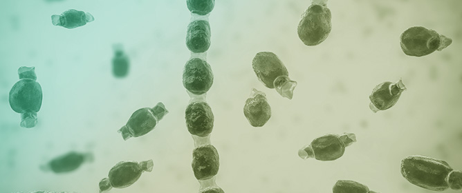 Environmental Detection of <em>Coccidioides</em>: Challenges and Opportunities